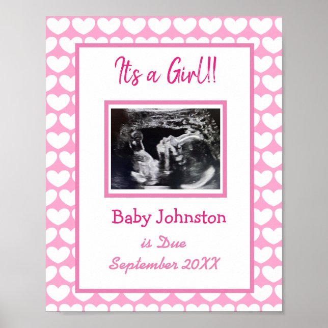 Poster C'est une fille, Grossesse Faire-part Ultrasound P (Devant)