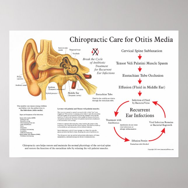 Poster Chiropractic Care for Otitis Media Ear Infections (Devant)