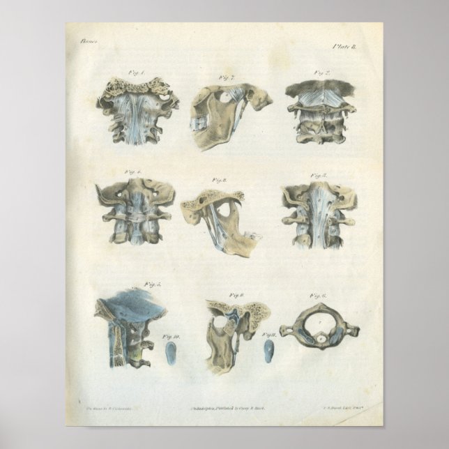 Poster Chiropratique de l'anatomie supérieure cervicale e (Devant)