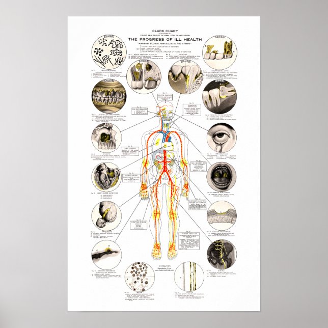 Poster Clark Dental Health Chart pour dentiste (Devant)