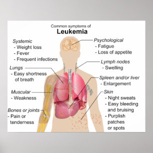 Poster Common Symptoms Chart of Leukemia Blood Cancer