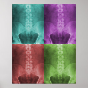 Poster Copie d'art de rayon X de Digitals