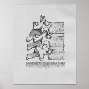 Poster Copie vintage de subluxation de chiropractie