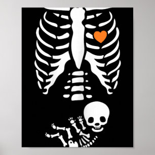 Poster Costume de Grossesse de Radiographie de Squelette