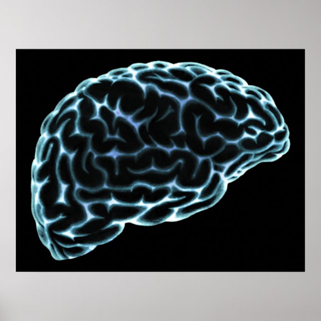 POSTER CÔTÉ CERVEAU XRAY VOIR BLEU (Devant)
