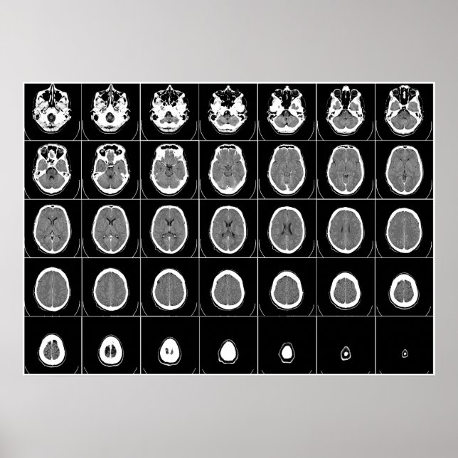 POSTER CT SCAN DE TÊTE (Devant)