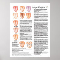 Poster de diagnostic de la langue chinoise de l'ac