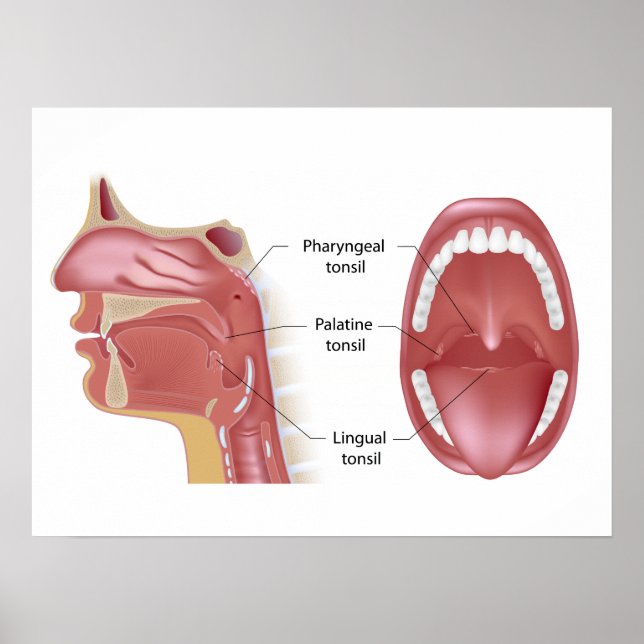 Poster de Tonsils (Devant)