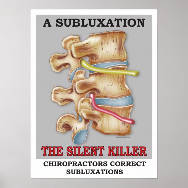 Poster de tueur silencieux de subbluxe chiropratiq (Devant)