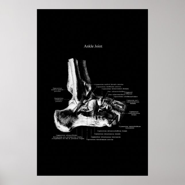 Poster Décor Orthopédique Anatomie Conjointe (Devant)