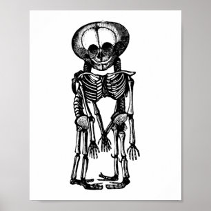 Poster déplaisant siamese jumeaux squelette enfants anato