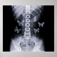 Poster des papillons conceptuels à rayons X