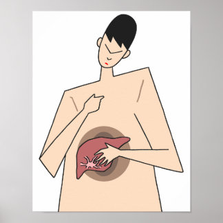 Poster Détection précoce des maladies du foie.