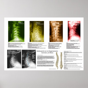 Poster Diplôme de la colonne vertébrale du Cervical Sublu