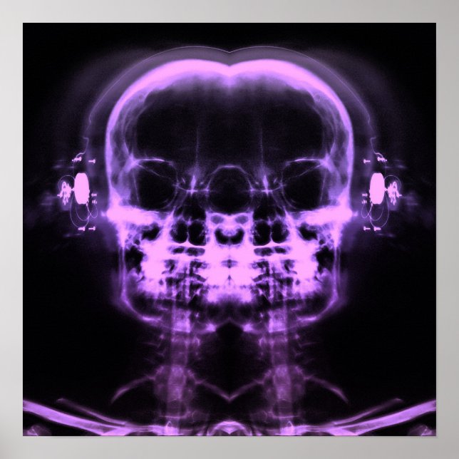 Poster Double crâne à rayons X avec casque - violet (Devant)