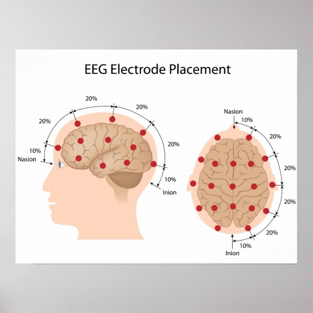Poster du diagramme de placement d'électrode EEG (Devant)