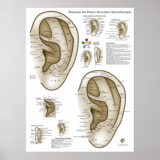 Poster Graphique d'Acupuncture de l'Oreille Espagnol