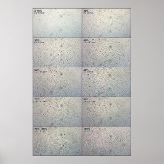 Poster Graphique de suivi de confluence