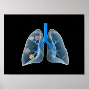 Poster Image Conceptuelle Du Coeur Humain 4