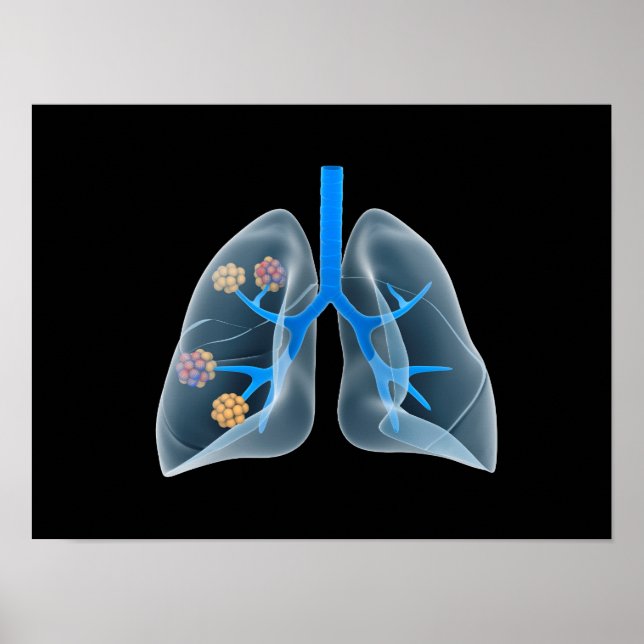 Poster Image Conceptuelle Du Coeur Humain 4 (Devant)