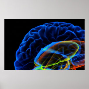 Poster Image par rayons X du cerveau