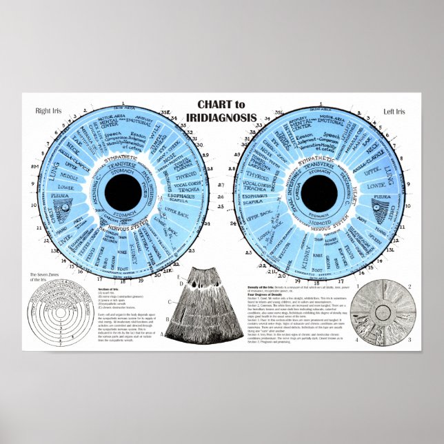 Poster Iridiagnosis Iridology Eye Chart  (Devant)