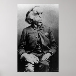 Poster Joseph "John" Merrick Elephant Man à partir de