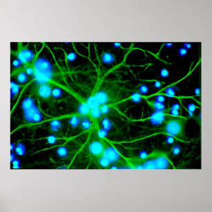 Poster Les Astrocytes sont des cellules globulaires en fo