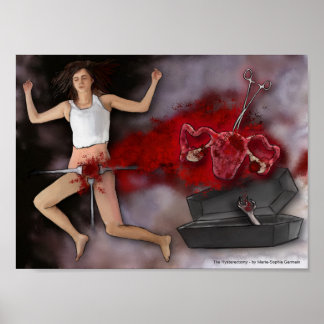 Poster L'hystérectomie