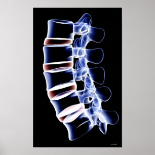 Poster Lumbar Vertebrae