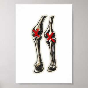 Poster Mauvais Genoux – Illustration Drôle de Squelette d