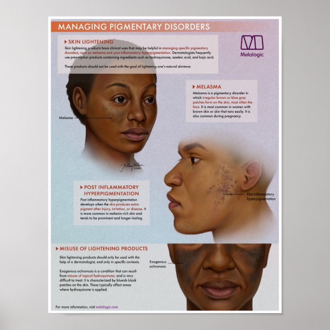 Poster Médicale d'éclaircissement de la peau en mé (Devant)