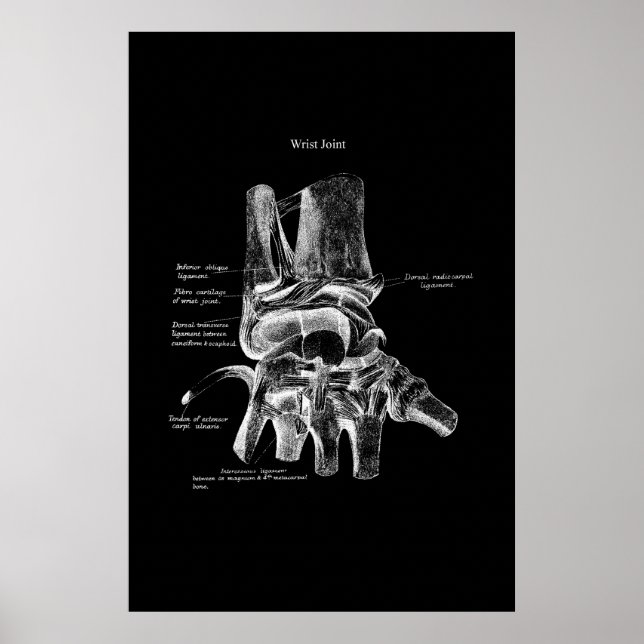 Poster Médicale Poster Poster Orthopédique Décor (Devant)