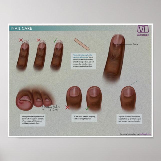 Poster Melalogic Nail Care Médicale (Devant)