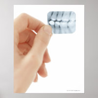 MODÈLE PUBLIÉ. Radiographie dentaire.