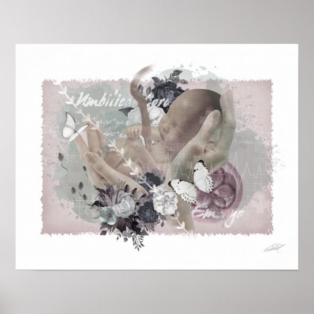 Poster Obgyn (Devant)