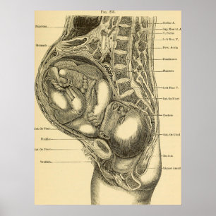 Poster Obstetrics Illustration