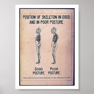 Poster Position Du Squelette En Bonne Et En Mauvaise Posi