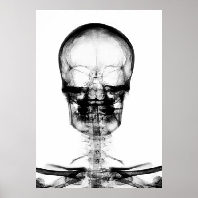 POSTER POSTER/IMPRIMER X RAY VISION SKELETON SKULL - B&W (Devant)