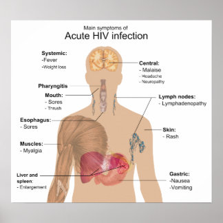 Poster Principaux symptômes de l'infection aiguë par le V