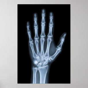 Poster Radiographie clinique de la main