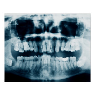 Poster Rayon X des dents
