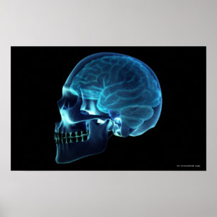 Poster Rayon X du cerveau à l'intérieur d'un crâne