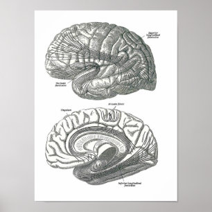 Poster Régions de matière blanche du cerveau