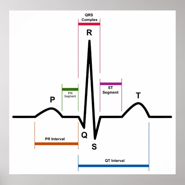 Poster Rythme sinus dans un diagramme ECG d'électrocardio (Devant)