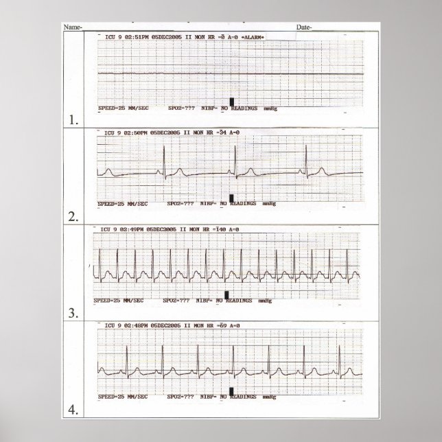 Poster rythmes ekg (Devant)