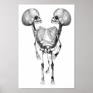 Poster Siamese joint Twins Anatomy Skeletons art
