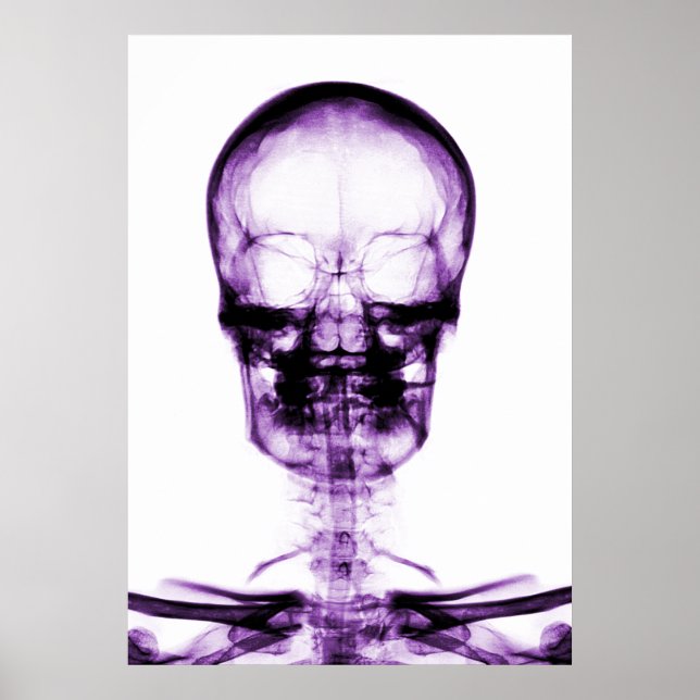 POSTER SKELETON DE VISION X-RAY SKULL - PURPLE (Devant)