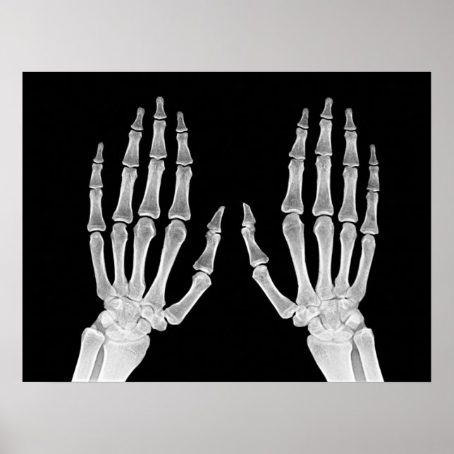 Poster Skeleton Hands Xray Photo Anatomie humaine photo (Devant)