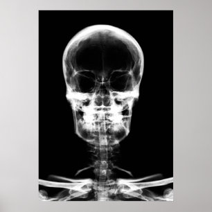 POSTER SKELETON VISION X-RAY SKULL - B&W